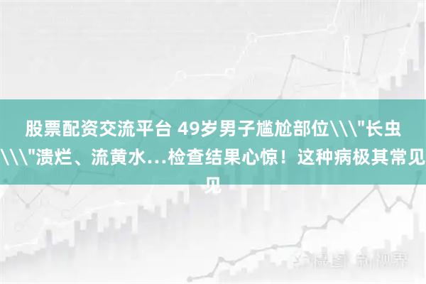 股票配资交流平台 49岁男子尴尬部位\